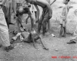 Concerned people (include at least to American GIs) surround a sick Chinese youth. The were many sick and weakened during the Chinese civilian evacuation in Liuzhou city, Guangxi province, China, during WWII, in the summer or fall of 1944 as the Japanese swept through as part of the large Ichigo push.